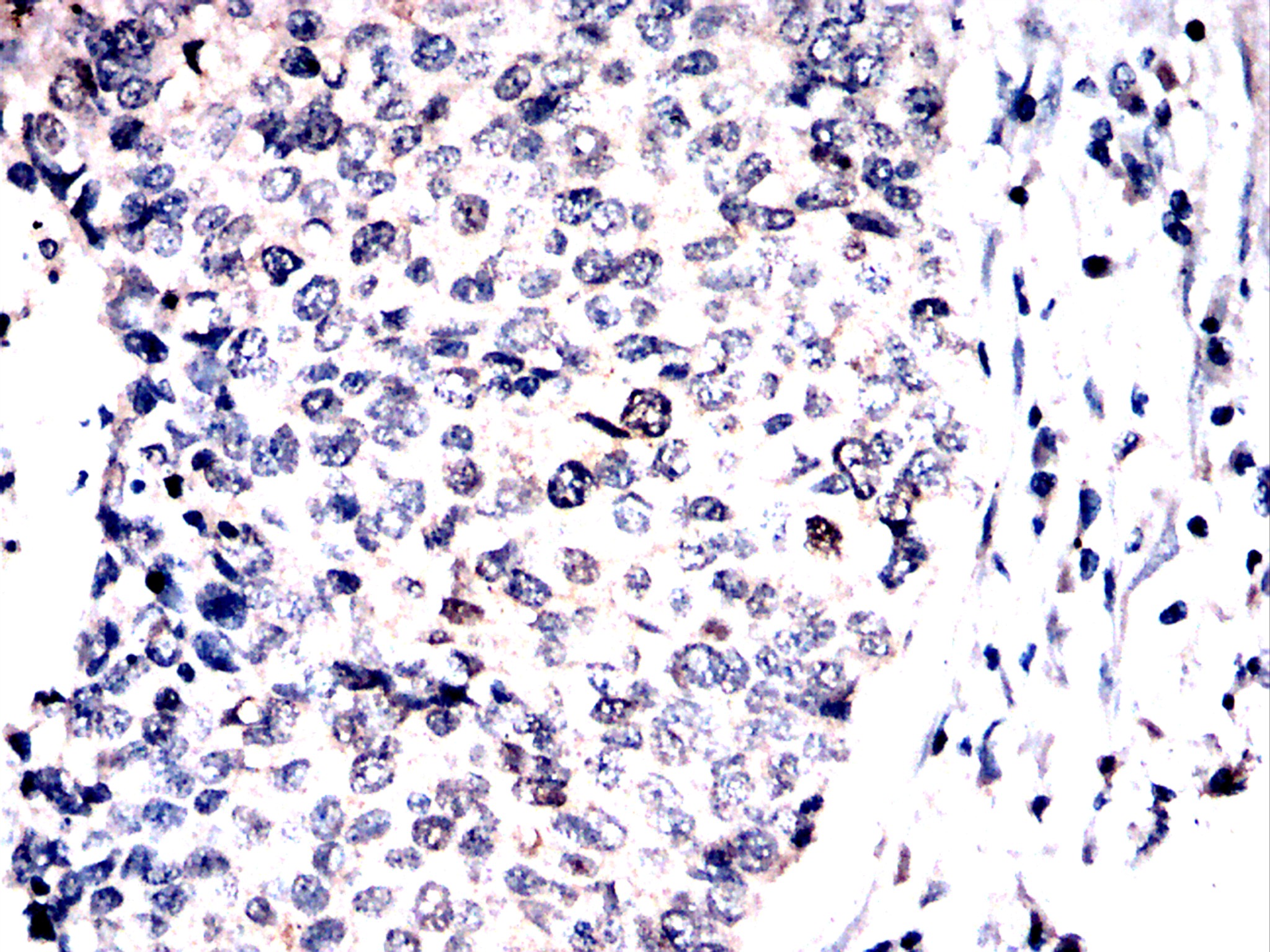 IHC